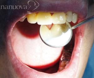 Le famiglie meno abbienti avranno il dentista gratis