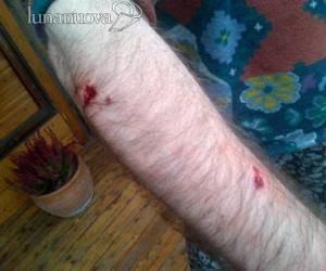 Aggredito dal rottweiller nel bosco
