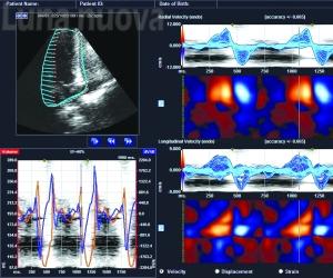 Asl To3: un salto nel futuro con la ‘radiologia digital’