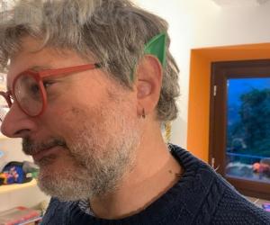Carenza di medici nelle valli: in Piemonte 50 in meno in tre anni
