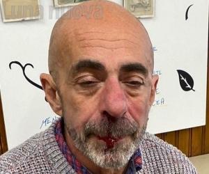 S.Antonino, aggredito davanti al bar-ristorante: naso rotto e dolori