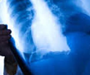 Al via il nuovo servizio di radiologia domiciliare
