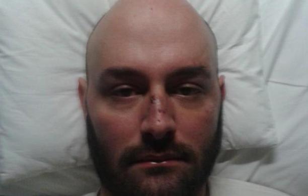 Pestato a sangue perché omosessuale