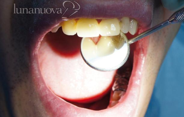 Le famiglie meno abbienti avranno il dentista gratis