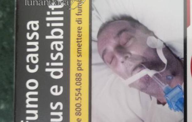 Orbassano, la foto del padre in ospedale per la campagna antifumo 