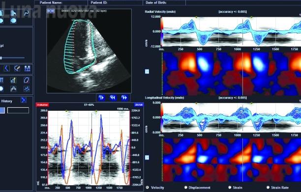 Asl To3: un salto nel futuro con la ‘radiologia digital’