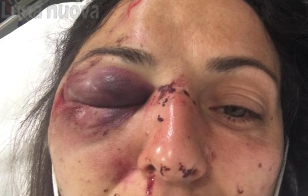 Attivista No Tav ferita da un lacrimogeno, ora è in ospedale: la questura si difende