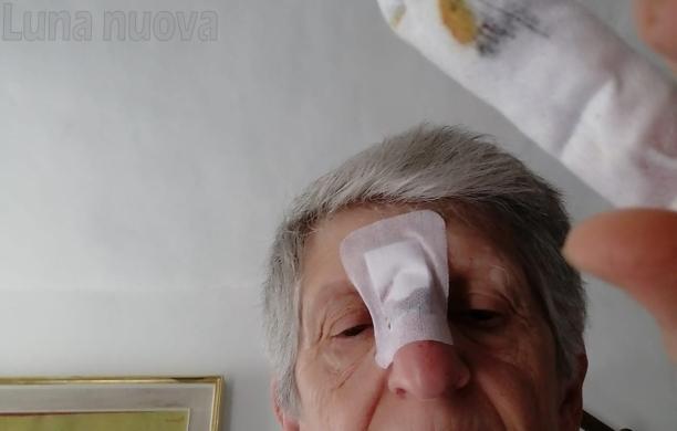 Cade sul selciato in piazza d'Armi: «Non è la prima volta che succede»