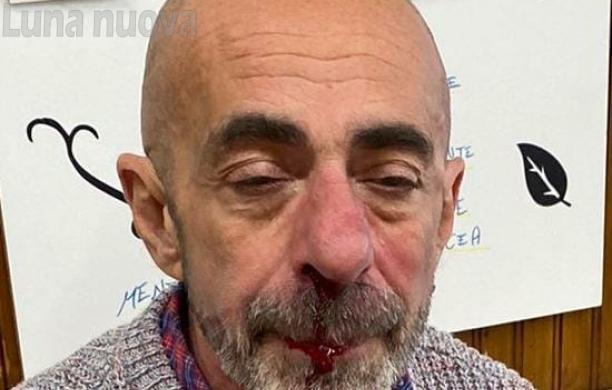 S.Antonino, aggredito davanti al bar-ristorante: naso rotto e dolori
