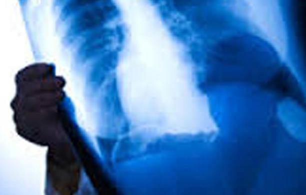 Al via il nuovo servizio di radiologia domiciliare
